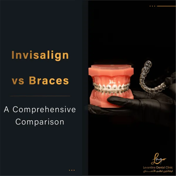 Invisalign vs Braces