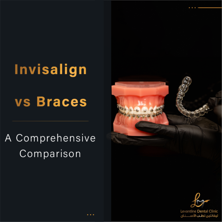 Invisalign vs Braces: A Comprehensive Comparison