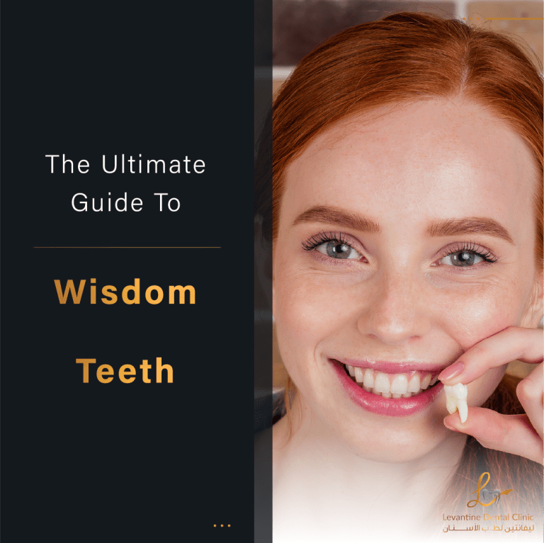 Guide to Wisdom Teeth