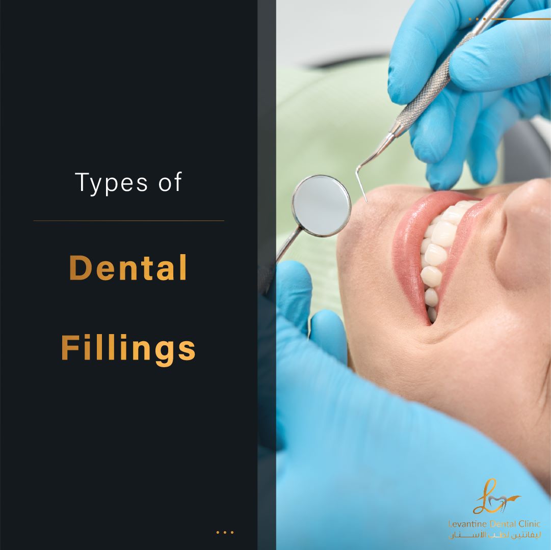 Types of Dental Fillings