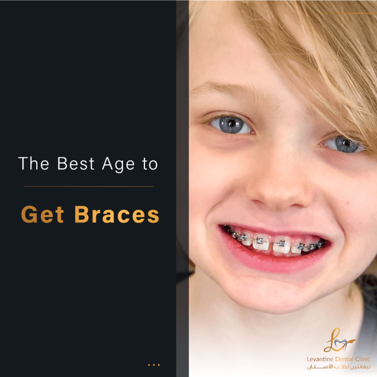 The Best Age to Get Braces