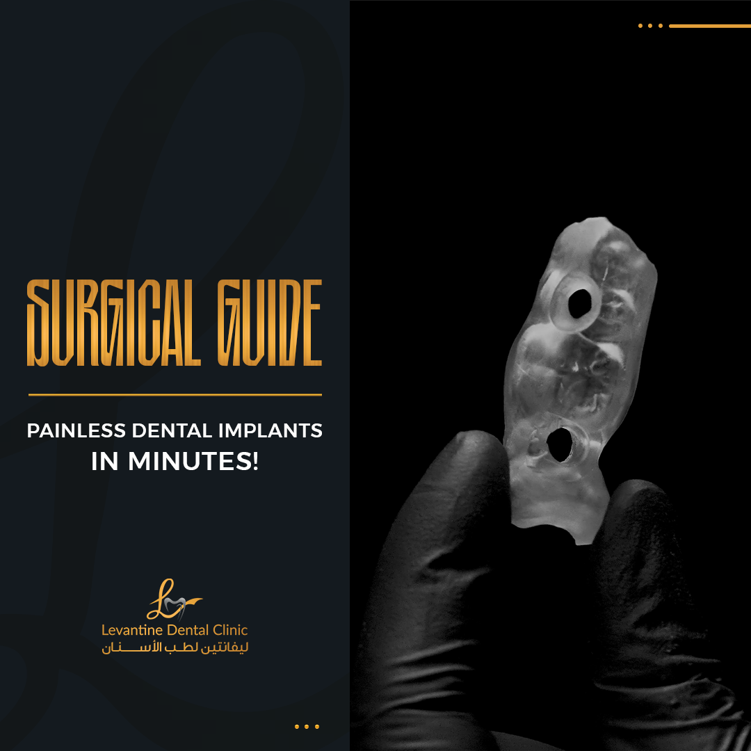 Painless Dental Implants in Minutes