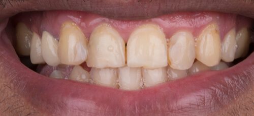 Case 10 - Before