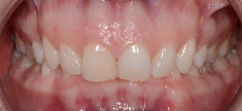 Case 11 - Before