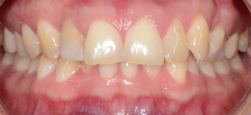Case 12 - Before