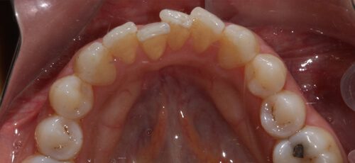 Case 13 - Before