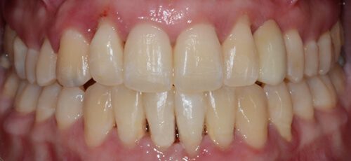 Case 15 - After