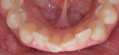 Case 16 - Before