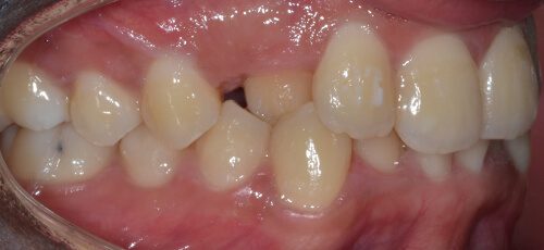 Case 17 - Before