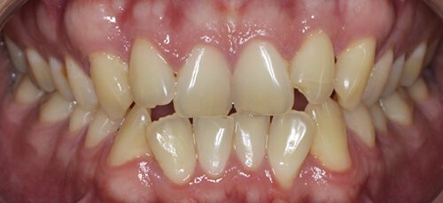 Case 18 - Before