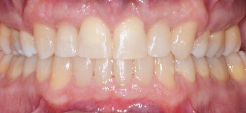 Case 19 - After