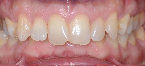 Case 19 - Before