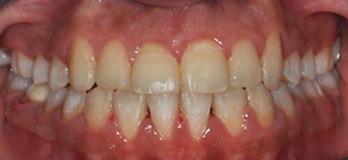 Case 2 - After