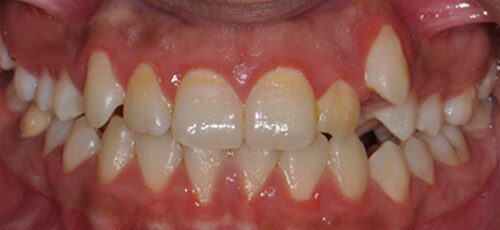Case 2 - Before
