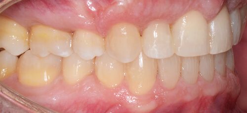 Case 20 - After