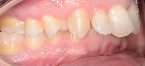 Case 20 - Before