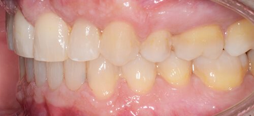 Case 21 - After
