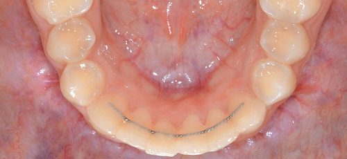 Case 25 - After