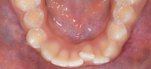 Case 25 - Before