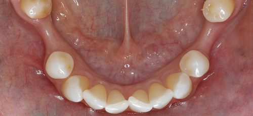 Case 26 - After