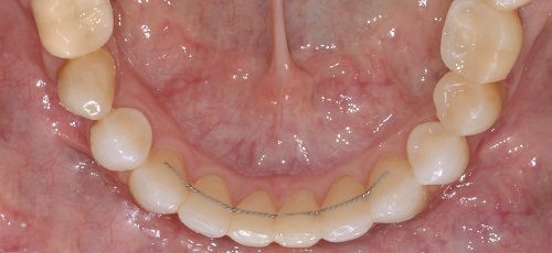 Case 26 - Before
