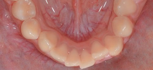 Case 28 - Before