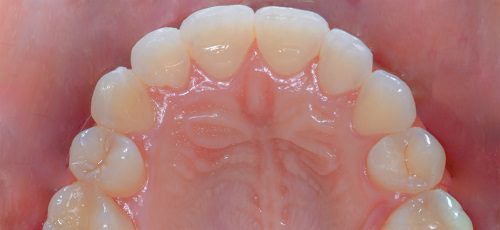 Case 30 - Before