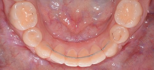 Case 32 - Before