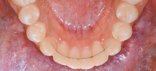 Case 36 - Before