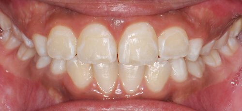 Case 4 - After