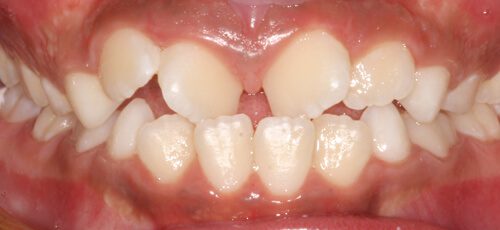 Case 4 - Before