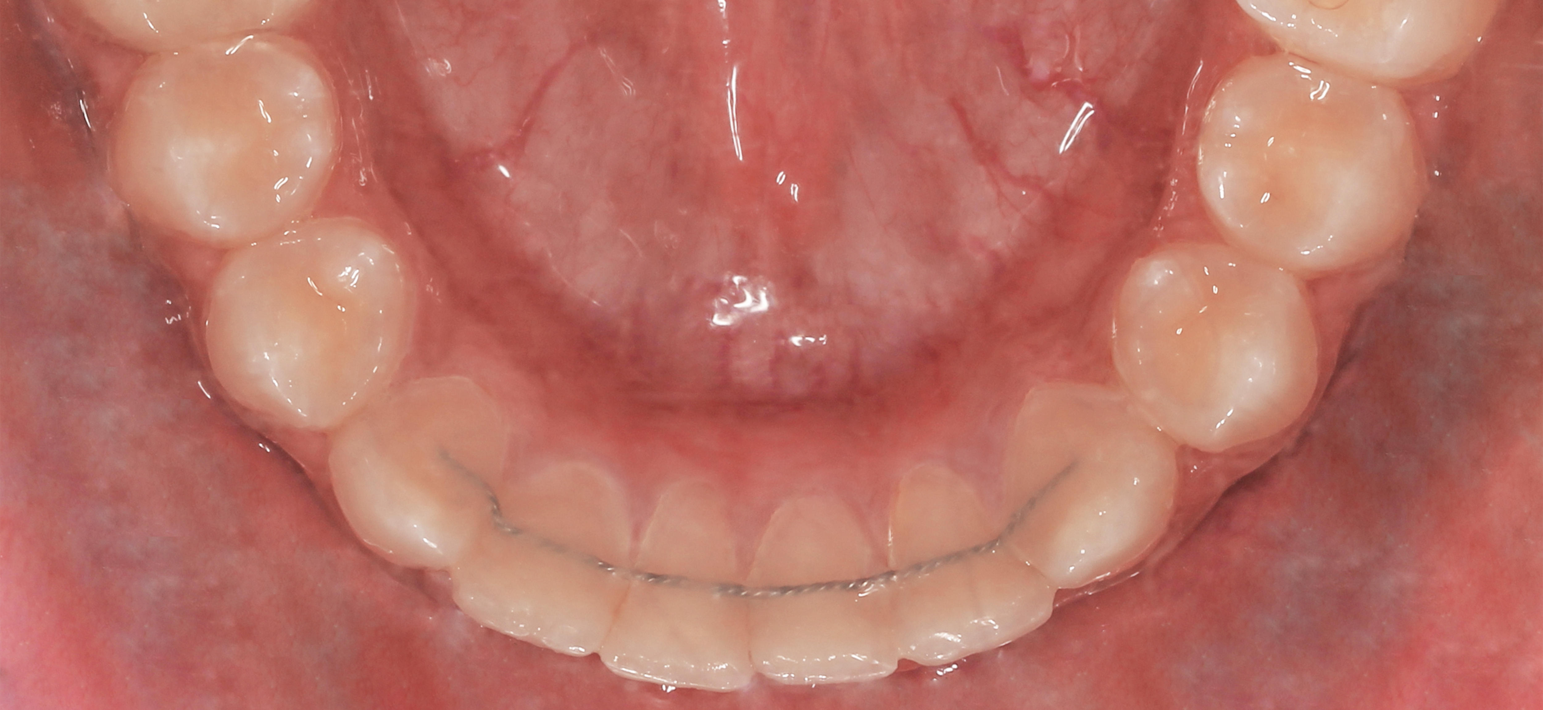 Case 40 - Before