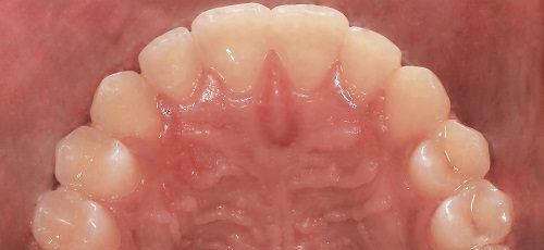 Case 41 - After