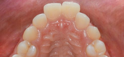 Case 42 - Before