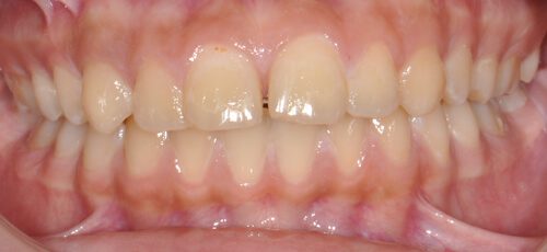 Case 5 - Before