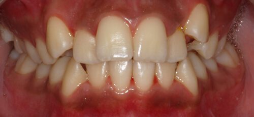 Case 6 - Before