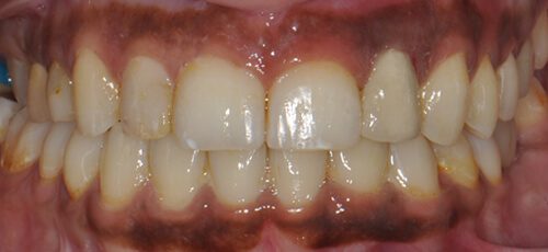 Case 9 - After