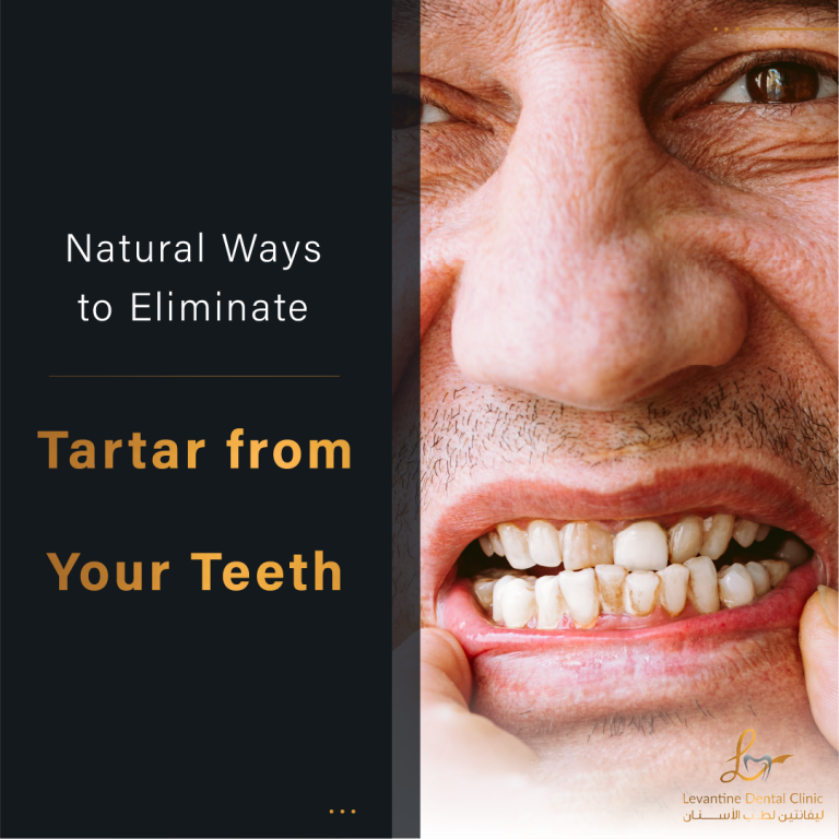 Eliminate Tartar