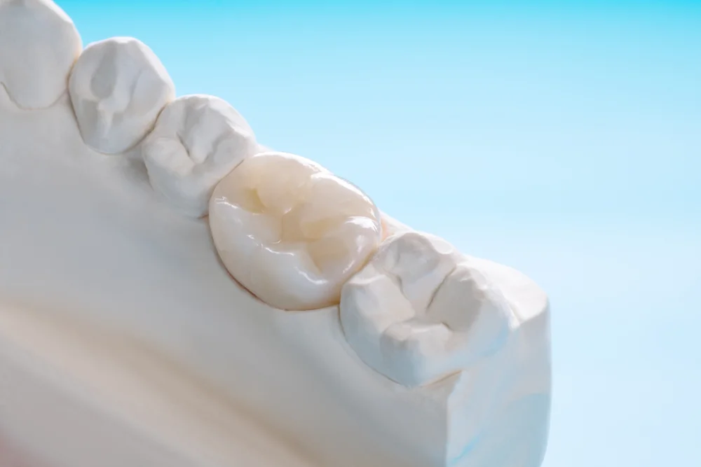 Zirconia Crowns