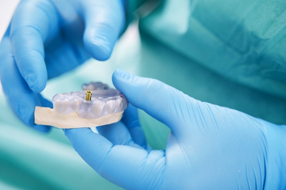 Dental Implant Procedure