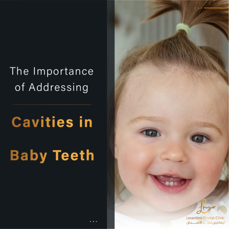 Cavities in Baby Teeth