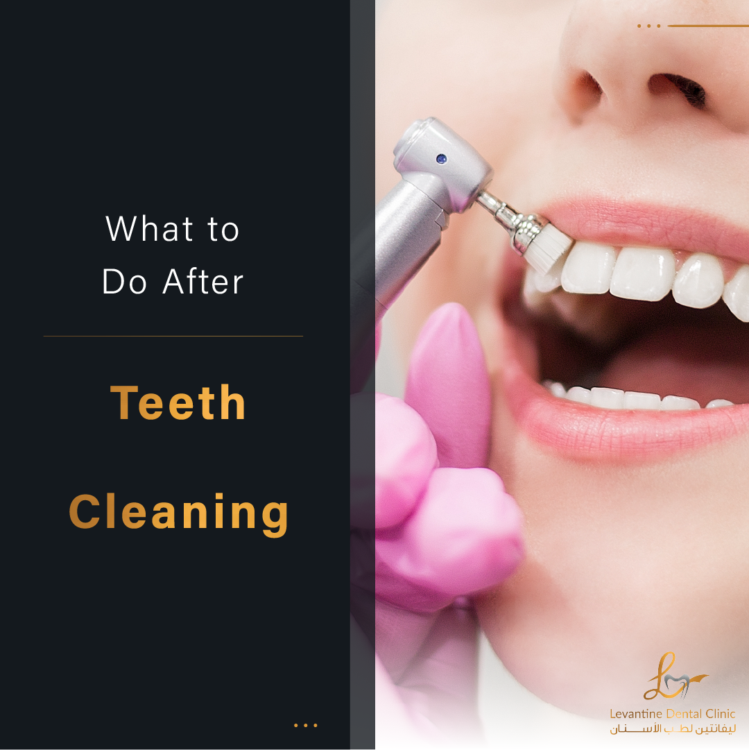 What to Do After Teeth Cleaning