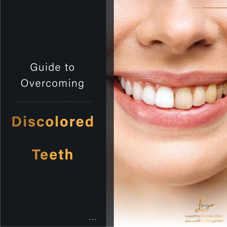Overcoming Discolored Teeth