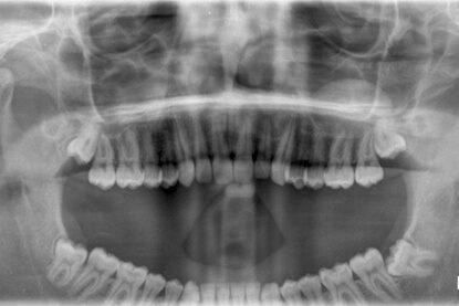 Monitor The Oral Health