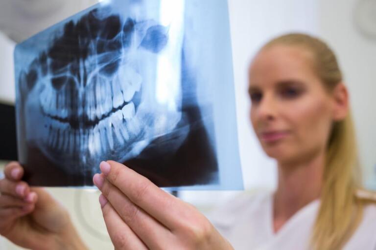 Dental X-Ray in Dubai