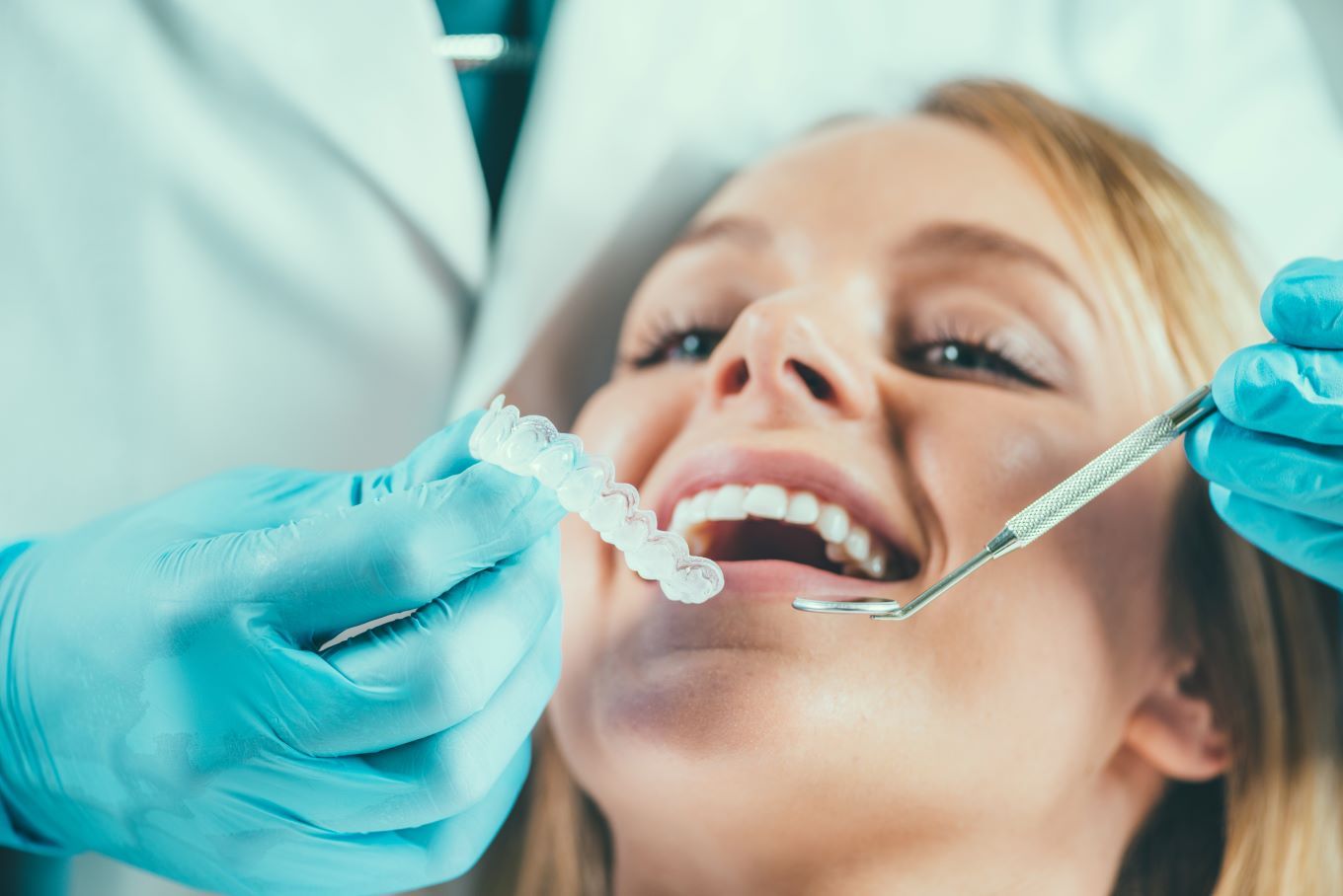 Benefits of EON Aligners