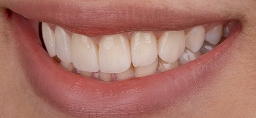 Case 17 - Before