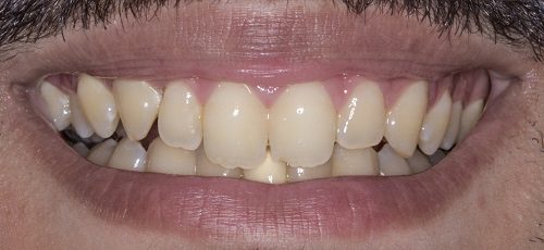 Case 1 - Before