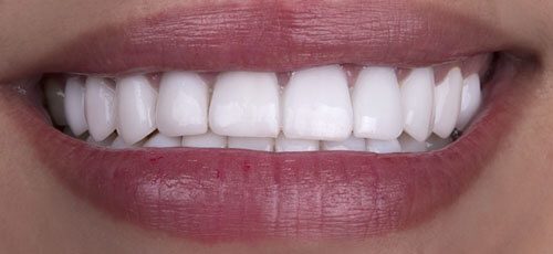 Case 28 - Before