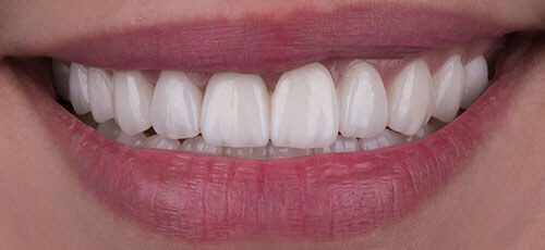 Case 28 - After